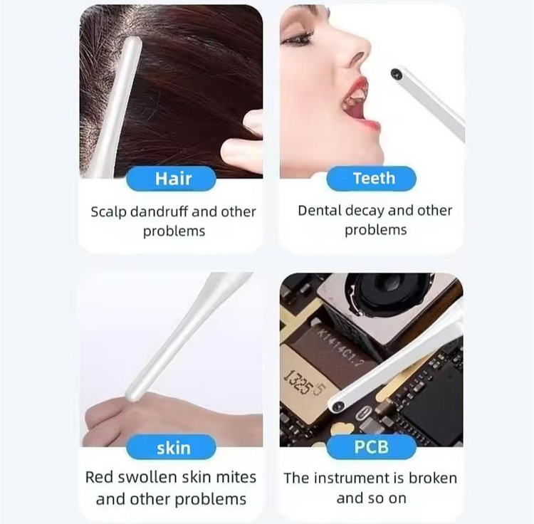 دوربین داخل دهانی Dental Camera- fy-b800
